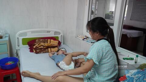 Sốt xuất huyết ở Đắk Lắk tăng mạnh, nhiều ca chuyển nặng bất ngờ