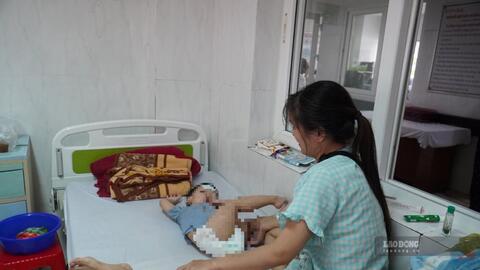 Sốt xuất huyết ở Đắk Lắk tăng mạnh, nhiều ca chuyển nặng bất ngờ