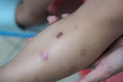 <a href="/thuong-hieu-xanh/van-de-hom-nay/moi-truong" title="Y tế" rel="dofollow">Y tế</a>