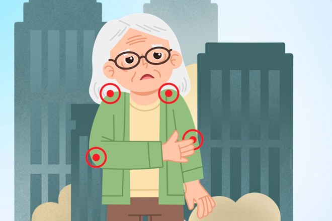 Ảnh hưởng của ô nhiễm không khí đến sức khỏe xương khớp