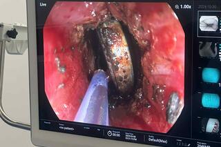 <a href="/van-de-hom-nay" title="Vấn đề hôm nay" rel="dofollow">Vấn đề hôm nay</a>