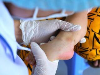 Tay chân miệng, sốt xuất huyết đồng loạt tăng tại bệnh viện tuyến cuối ĐBSCL