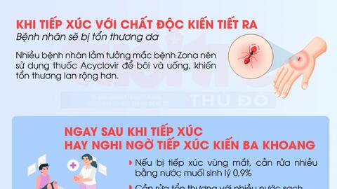 Hà Nội: Nhiều ca bệnh viêm da nặng do tiếp xúc với kiến ba khoang