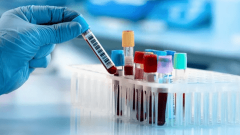 Thiết bị y tế AI - Bước đột phá trong quy trình xét nghiệm máu