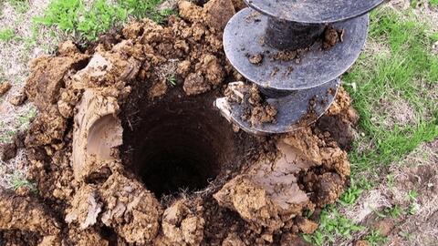 Phẫu thuật nữ bệnh nhân mất toàn bộ da đầu do tóc cuốn vào máy khoan