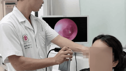 Bệnh nhân mắc viêm tai hiếm gặp do chảy mủ kéo dài nhiều tháng
