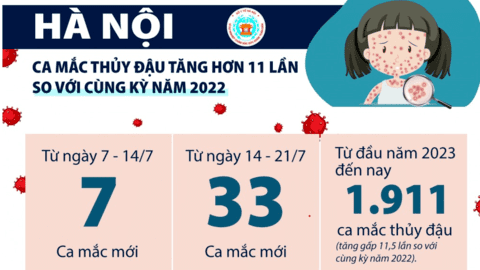 Hà Nội: Ca mắc thủy đậu tăng hơn 11 lần so với cùng kỳ năm 2022