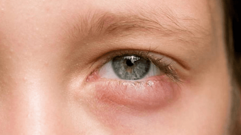 Thiếu quá nhiều vitamin A, cơ thể sẽ xuất hiện những tín hiệu này