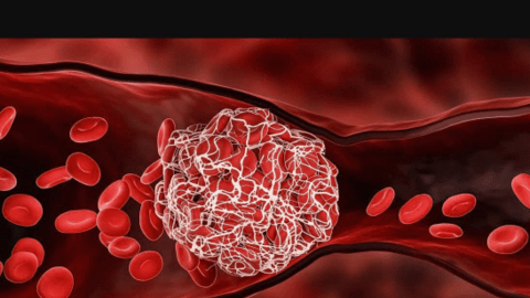 Mạch máu có 9 "nỗi sợ" vào mùa đông, bác sĩ cảnh báo người trên 40 tuổi cần cảnh giác