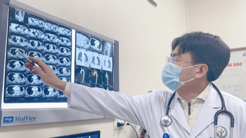 Liên tiếp ca nhập viện vì căn bệnh gây đột tử ở người khỏe mạnh, tỷ lệ tử vong 30% trong 24h đầu