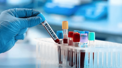 Thiết bị y tế AI - Bước đột phá trong quy trình xét nghiệm máu