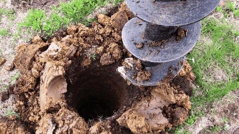 Phẫu thuật nữ bệnh nhân mất toàn bộ da đầu do tóc cuốn vào máy khoan