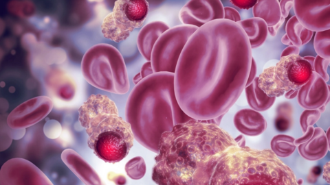 Cảnh báo: Điều nhiều người xem nhẹ có thể kích hoạt ung thư máu