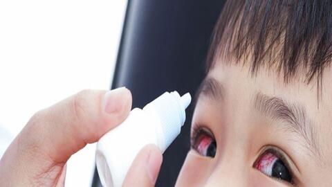 Đau mắt đỏ ở trẻ không lây qua "nhìn nhau"