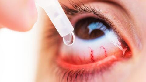 Xử lý nghiêm việc lợi dụng dịch đau mắt đỏ để tăng giá thuốc