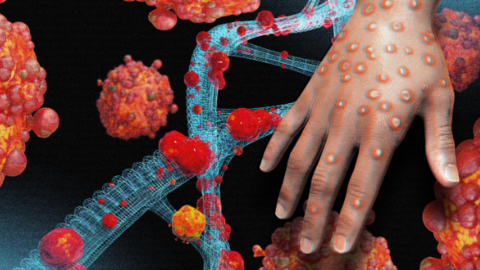 4 nhóm nghề có nguy cơ lây nhiễm bệnh đậu mùa khỉ