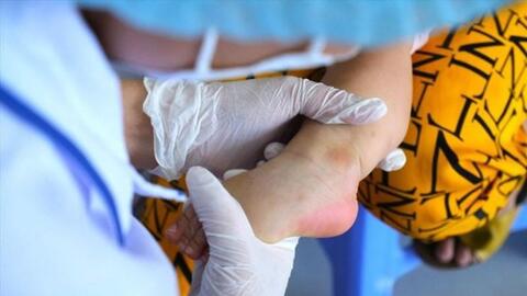 Tay chân miệng, sốt xuất huyết đồng loạt tăng tại bệnh viện tuyến cuối ĐBSCL