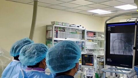Can thiệp thành công cho bệnh nhi 4 tuổi bị hẹp eo động mạch chủ