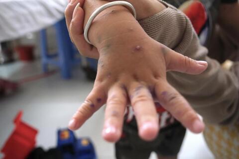 <a href="/thuong-hieu-xanh/van-de-hom-nay/moi-truong" title="Y tế" rel="dofollow">Y tế</a>