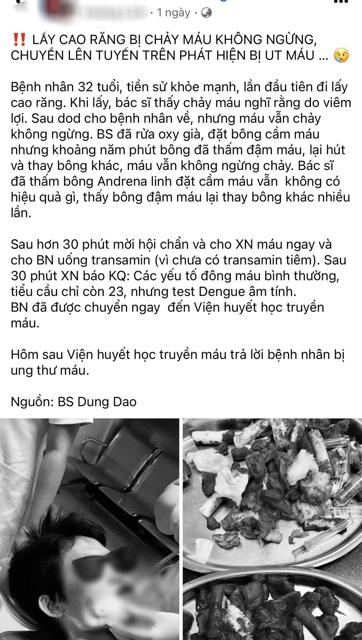 Lần đầu đi lấy cao răng bị chảy máu ồ ạt, bệnh nhân không ngờ bị ung thư máu- Ảnh 1.