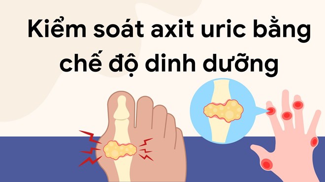 Những lưu ý kiểm soát axit uric bằng chế độ dinh dưỡng