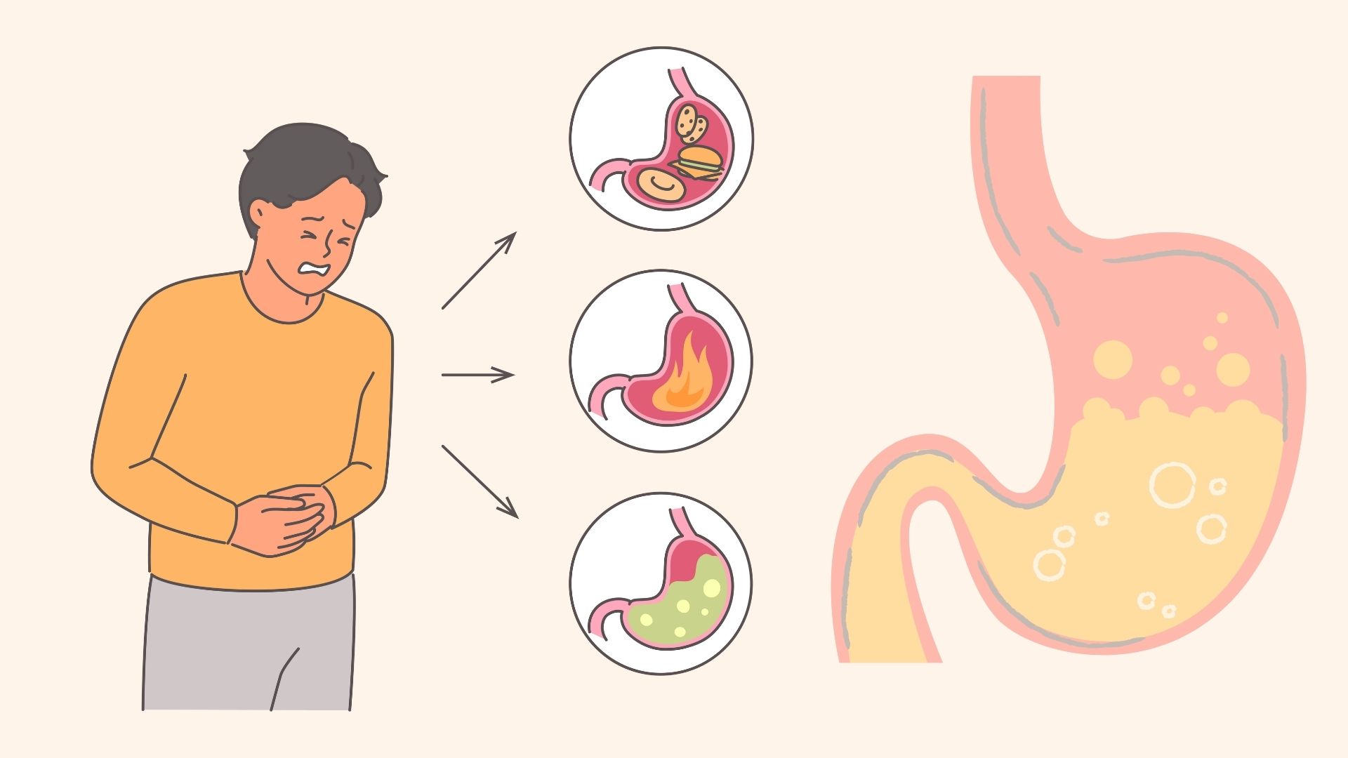 Các biện pháp khắc phục tại nhà để cải thiện tiêu hóa. Đồ hoạ: Đinh Đinh