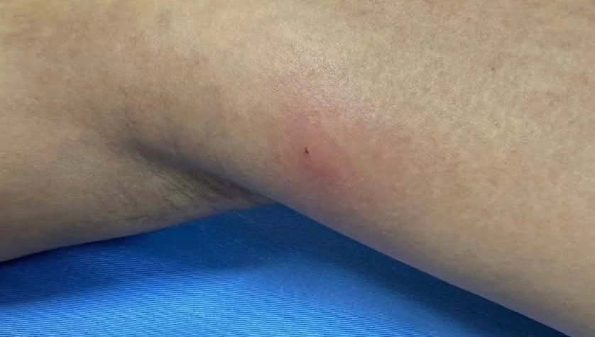 Các chuyên gia cảnh báo thói quen ăn đồ sống.