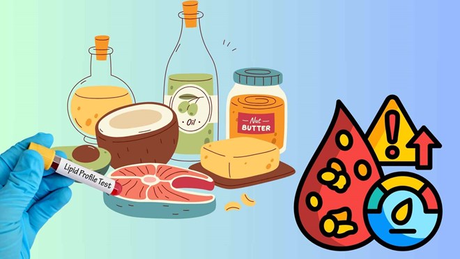 Cách để ngăn ngừa rối loạn mỡ máu