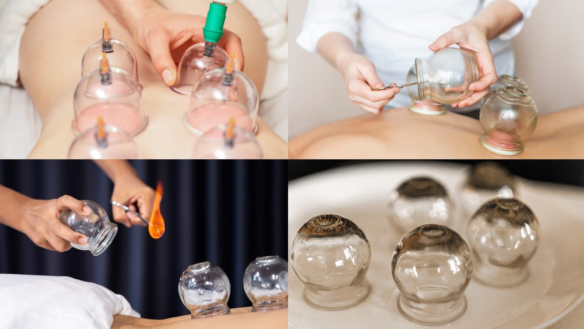 Giác hơi và những tác động tích cực lên làn da. Đồ họa: Minh Hoàng