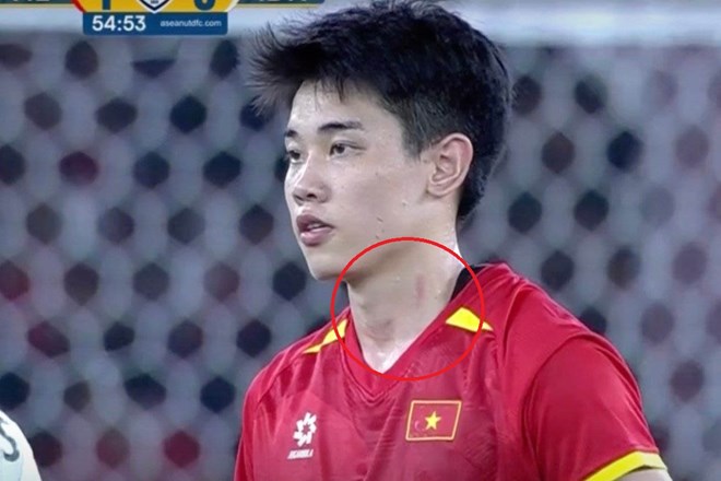 Đình Bắc giữ bình tĩnh dù bị đối thủ chơi xấu ở chung kết U23 Đông Nam Á
