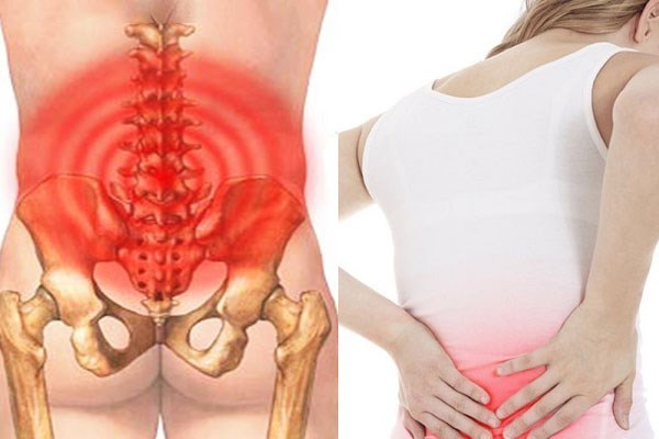 Mối liên hệ gián tiếp nhưng đáng lưu ý giữa thói quen ăn đường và bệnh đau lưng
