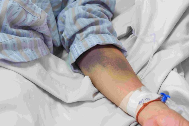 Cảnh báo nguy cơ bùng phát sốt xuất huyết sau mưa lũ