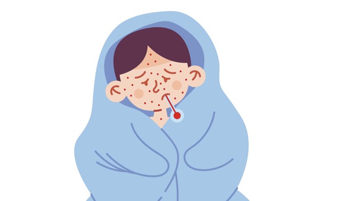 Sốt xuất huyết ngày thứ 4 cần lưu ý dấu hiệu chuyển nặng